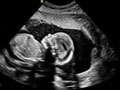 Ultrasound thumbnail